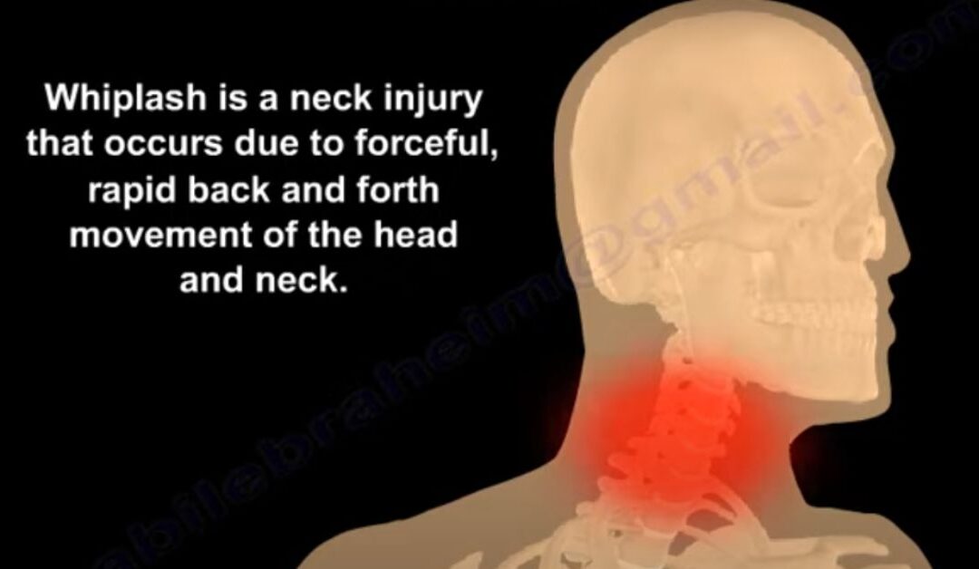 Whiplash injury